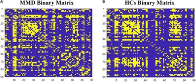 Reorganization of the Brain Structural Covariance Network in Ischemic Moyamoya Disease Revealed by Graph Theoretical Analysis